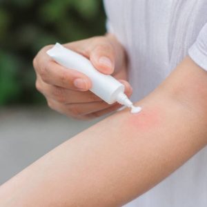 Creme cortisone piqure de moustique : usage, efficacité et conseils