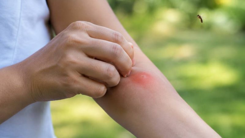 Les moucherons piquent-ils ? Tout savoir sur leurs morsures et les moyens de s’en protéger