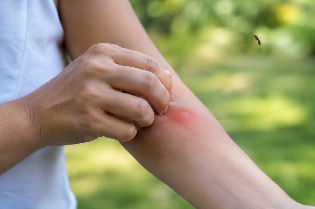 Les moucherons piquent-ils ? Tout savoir sur leurs morsures et les moyens de s’en protéger