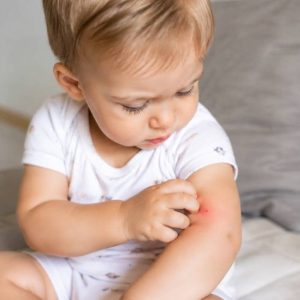 Bébé piqûre de moustique : que faire pour soulager les démangeaisons ?