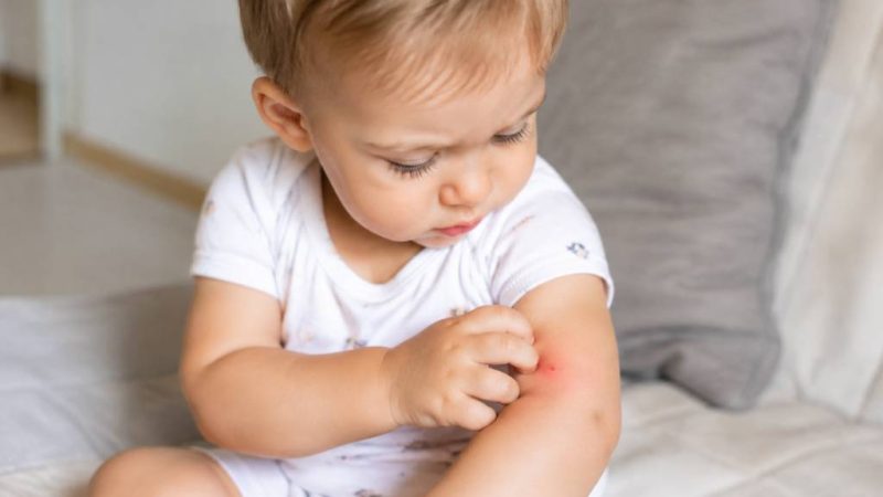 Bébé piqûre de moustique : que faire pour soulager les démangeaisons ?